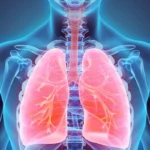 WA Cancer Staging Project Lung Cancer Working Group -  Consumer Representatives