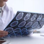 Is Copper at the Core of Multiple Sclerosis Risk Factors?