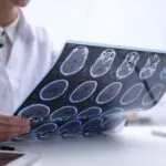 Is Copper at the Core of Multiple Sclerosis Risk Factors?