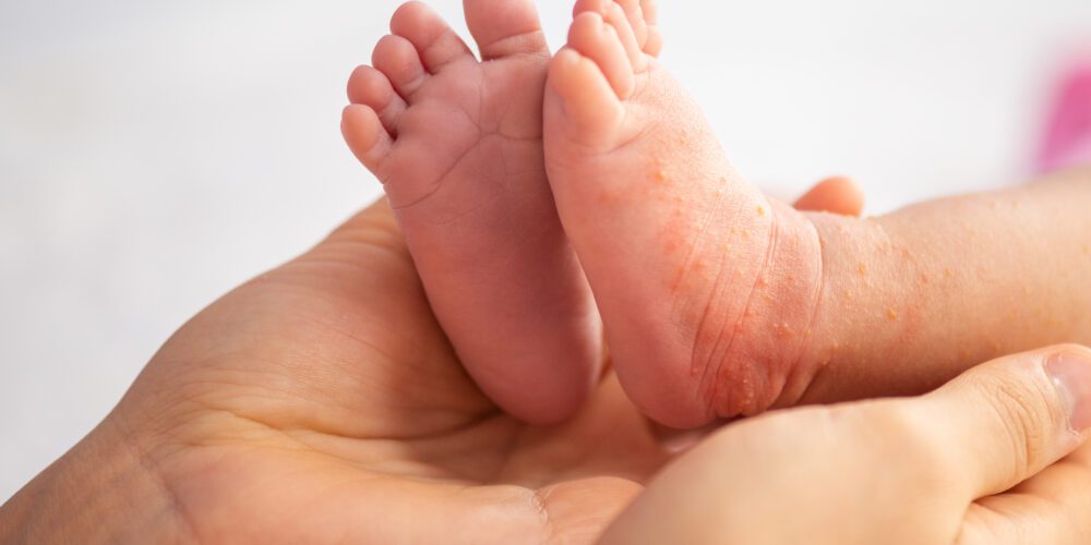Research reveals many newborn baby deaths linked to preventable or treatable factors