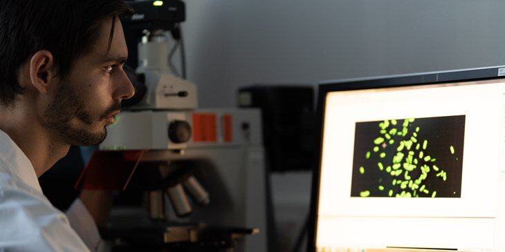 Microbiologically Influenced Corrosion